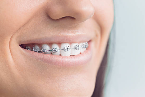 Reliable Cassville, WV Dental Services Solutions